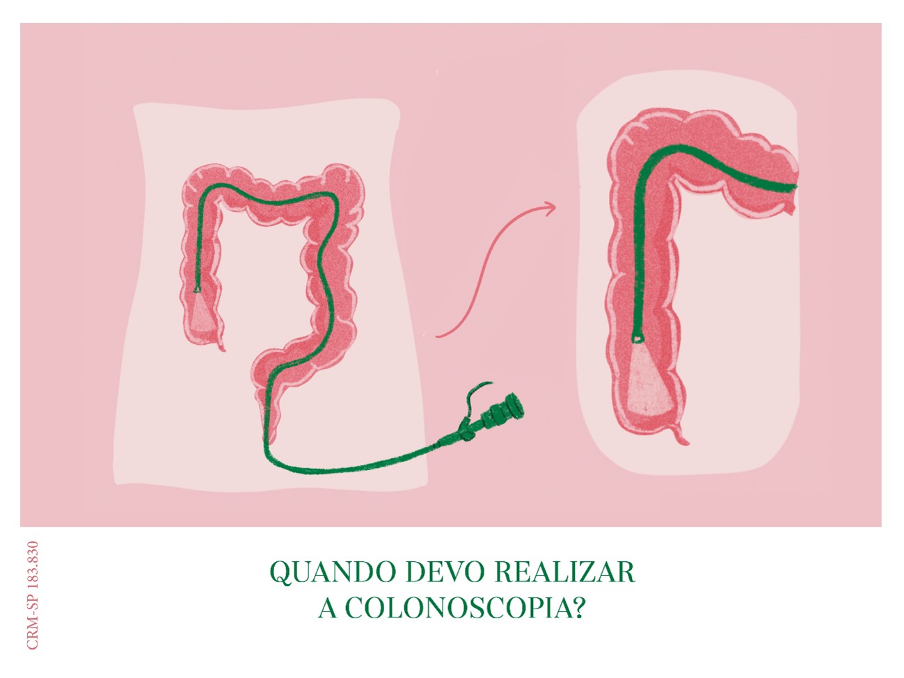 O que é a colonoscopia? - Dra. Aline Celeghini Coloproctologista